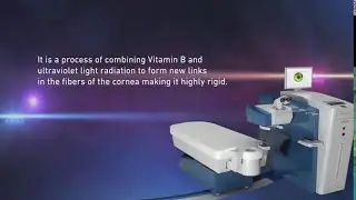 What Is Corneal Collagen Cross Linking? | Shinagawa Philippines