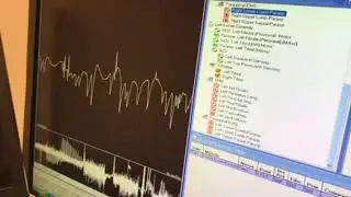Abnormal EMG Findings