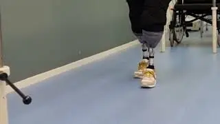 Lopen op (vacuum)protheses bij dubbele onderbeen amputatie (feb 2023)