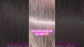 How many lice bugs are there 🤔 l Lice Removal Service @Thelousegirl