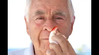 Common Cause of Winter Nosebleeds