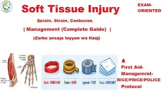 Soft tissue injuries and its management