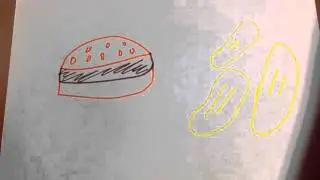 Arteries and Cholesterol