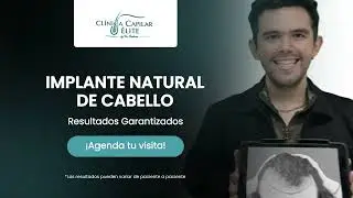 Implante natural de cabello - Cl&iacute;nica Capilar Elite