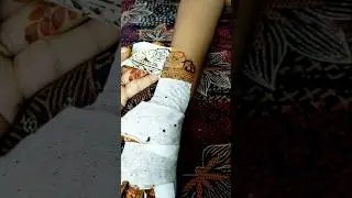 Mefix tape removing #mefixtape #shortfeed #shorts #ishalshenna #hennahack #hennaart