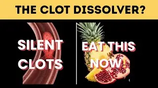 Doctor's Warning! Your Body Is Forming Silent, Deadly Clots. Eat These 14 Fruits IMMEDIATELY.