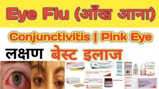 Eye Flu | Viral Infection | Conjunctivitis