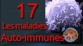 17 : Les maladies auto-immunes