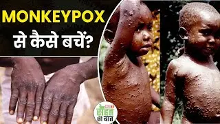 Monkey Pox Virus Precuation: मंकीपॉक्स से बचाव के लिए क्या करें, ये किसके लिए है ज्यादा खतरनाक?