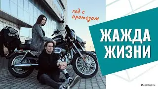 Lost a leg in a motorcycle accident