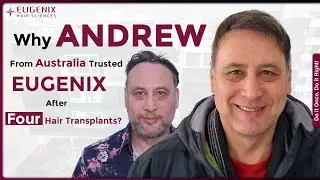 Why Eugenix Was Andrew&rsquo;s Final Answer After 4 Hair Transplants!