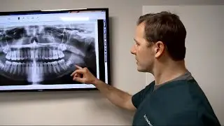 Stem Cells From Wisdom Teeth Could Help Paralyzed Man Walk Again
