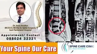#L3-4 listhesis #decompressionL4-5, L5-S1 #fusion #spine Laminactomy #microscopic #fixation 