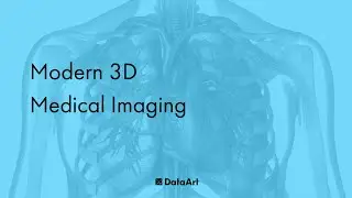 Modern 3D Medical Imaging (Video Teaser)