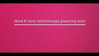 Head and neck radiotherapy planning scan