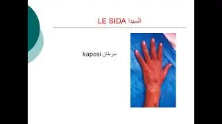 lutte contre le VIH/sida pr&eacute;sentation sida 2010   لا يعدي عن طريق الاتصالات الانسانية اليومية VIH