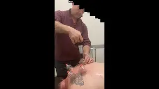 Moving Cupping at Optimum Physiotherapy  Fast Relief for Tight Muscles