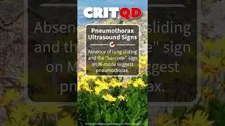 Pneumothorax Ultrasound Signs