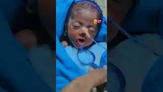 baby feeding time #babyshorts #babyhealth #babycare
