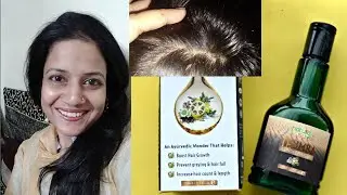 THUMBA WONDER HAIR OIL BY NATURE SURE | REDUCE HAIR FALL AND LOSS
