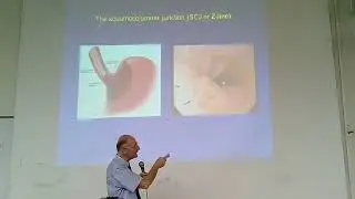 باطنة هضمية | أمراض المري المكتسبة Acquired esophageal diseases د رائد أبو حرب