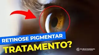 Existe tratamento para retinose pigmentar ?