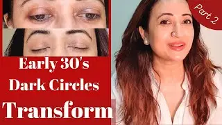 Best Eye Cream For Wrinkles, Dark Circles, Pigmentation, Fine lines 30s Guide|  Questions on EYECARE