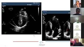 Webinar 7: Hypertrophic Cardiomyopathy, Case Based Discussion