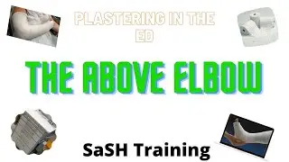 Plastering in the ED - The Above Elbow POP Backslab