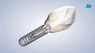 Dental Implants in Charleston WV | Mountain State Oral & Facial Surgery