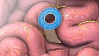Peristalsis Process
