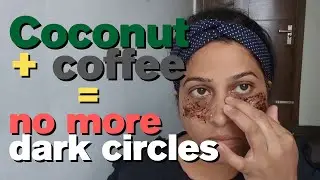 Coconut Oil + Coffee Powder से हटाएँ Dark Circles ☕✨ | Dark Circles Home Remedy