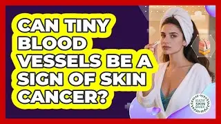 Can Tiny Blood Vessels Be a Sign of Skin Cancer?