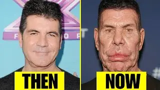 10 Shocking Failed Cosmetic Surgery Cases of Celebrities You Won't Believe | Then and Now 2026