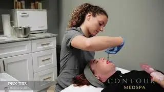 PRX T-33 Peel- How it works