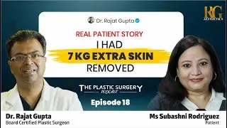 I Had 7 KG Extra Skin Removed | Tummy Tuck/Abdominoplasty Journey | Episode: 18 | Dr Rajat Gupta