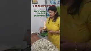 🔥 Fire cupping therapy techniques #cupping #therapy #ytshorts #shortsfeed #ayurveda