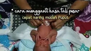 Cara mengganti kain kasa tali pusar &bull; mudah, aman, dan cepat kering &bull; Playlist Baby Newborn