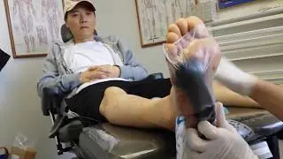 Wound VAC of a Diabetic Foot ulcer - Open Wound in Irvine, CA - Orange County