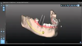 SMART Guide - Beautiful 3D visualization
