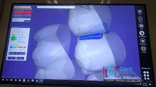 STEP 6: Connector Placement and Finalisation | Indent Dental Laboratory, Mumbai