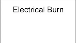 Electrical Burn