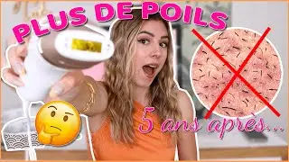 PLUS DE POILS... MON AVIS 5 ANS PLUS TARD !