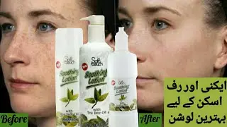 Best Soothing Lotion For Face , Benefits of Soothing Lotion ,How to use Soothing Lotion