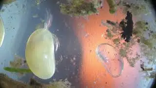 Crustaceu ostrocod microscopic, Cyprinotus cassidula sau Heterocypris ori  Candona candida ?
