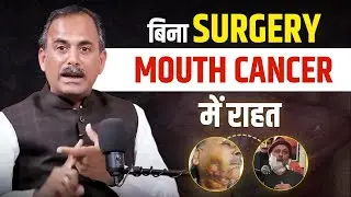 Mouth Cancer Treatment Without Surgery | 18 दिनों में मिला Mouth Cancer में आराम | Acharya Manish Ji