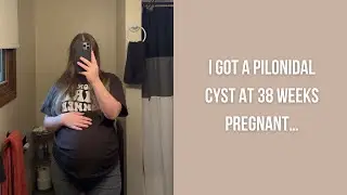 pilonidal cyst at 38 weeks pregnant | storytime, er visit & cost