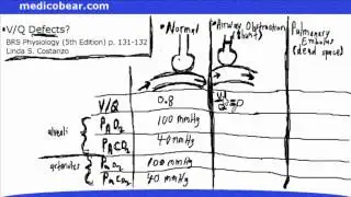 Ventilation Perfusion Defects STEP 1 Airway Obstruction Pulmonary Embolus