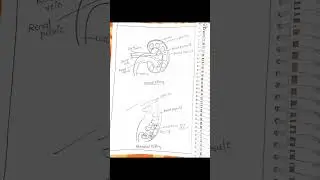 Wilm's tumor#anatomy #ahn #biology #case presentation #casestudy of wilms tumor