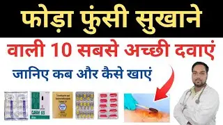 Foda funsi sukhane ki tablet | फोड़ा फुंसी की दवा  Antibiotics For Boils | Baltod treatment at home